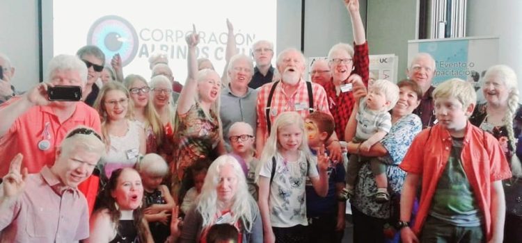 Corporación Albinos Chile busca financiar proyecto de salud mental